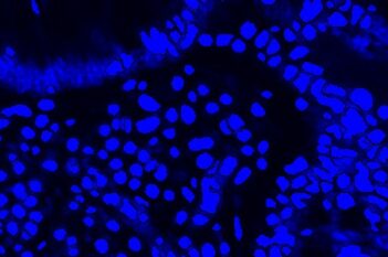 Nuclei Detection, AI (Fluorescence)