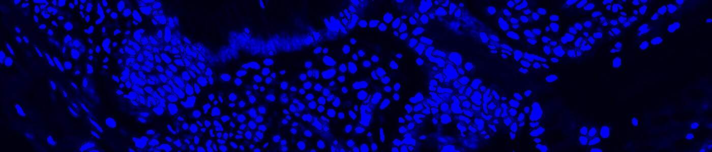Nuclei Detection, AI (Fluorescence)