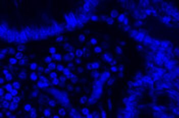 Nuclei Detection, AI (Fluorescence)
