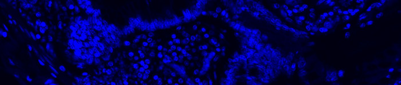 Nuclei Detection, AI (Fluorescence)