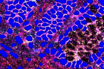 Nuclei Detection, AI (IMC)