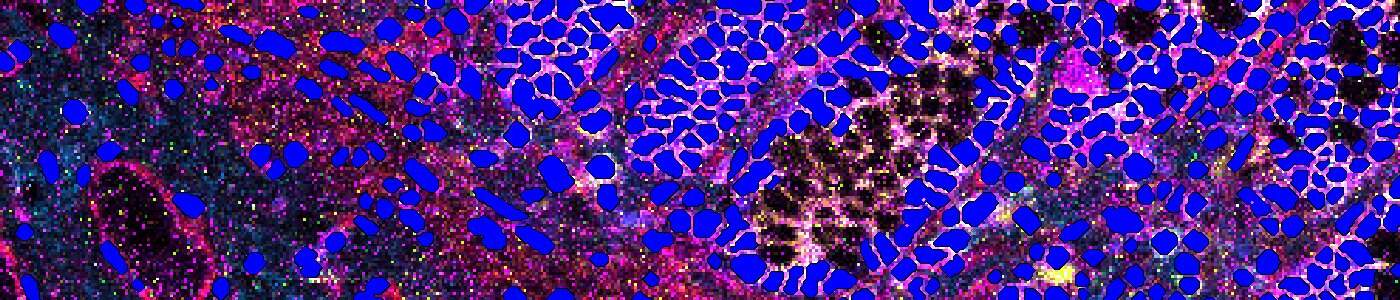 Nuclei Detection, AI (IMC)