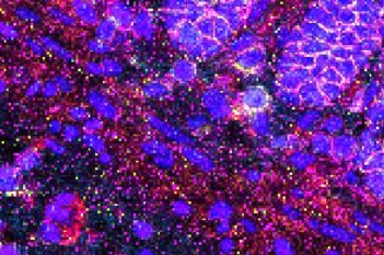 Nuclei Detection, AI (IMC)