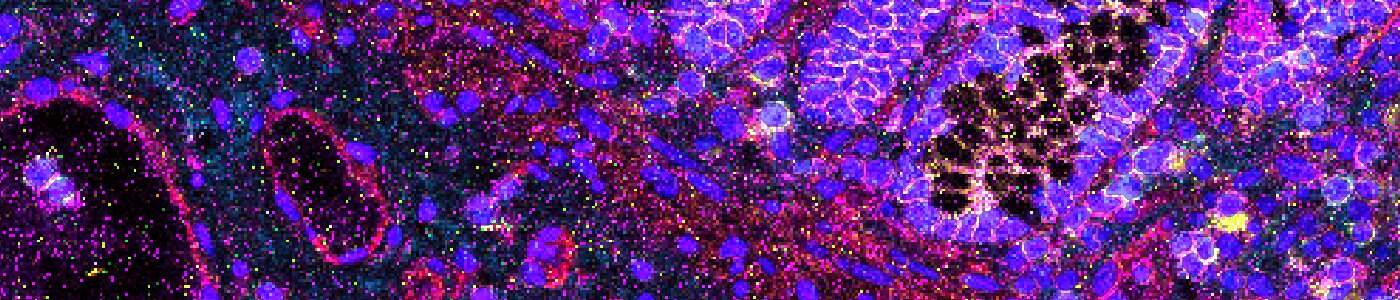 Nuclei Detection, AI (IMC)