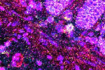 Nuclei Detection, AI (IMC)