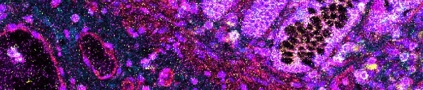 Nuclei Detection, AI (IMC)