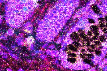 Nuclei Detection, AI (IMC)