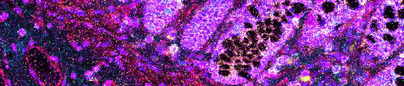 Nuclei Detection, AI (IMC)