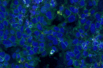 Nuclei Detection, AI (IMC)