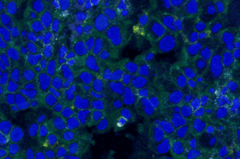 Nuclei Detection, AI (IMC)