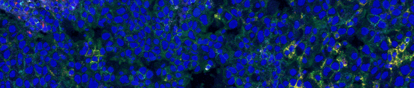 Nuclei Detection, AI (IMC)