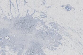 Tissue Detection (Brightfield)