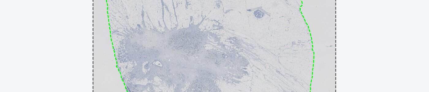 Tissue Detection (Brightfield)