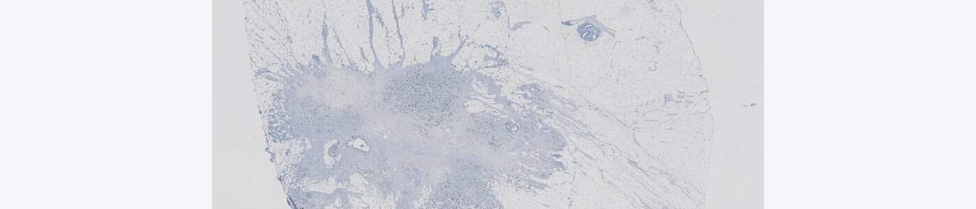 Tissue Detection (Brightfield)