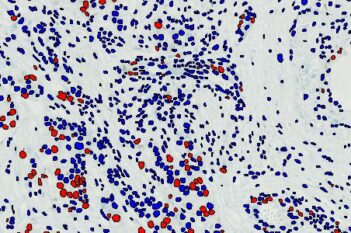 Nuclei DAB Quantification