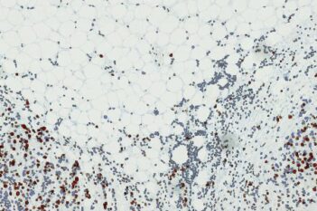 Nuclei DAB Quantification