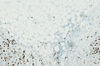 Nuclei DAB Quantification