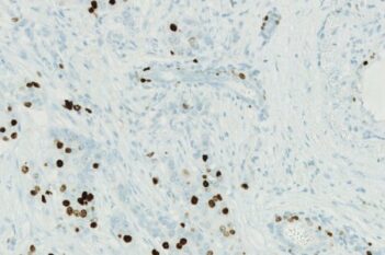 Nuclei DAB Quantification