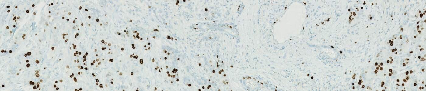 Nuclei DAB Quantification