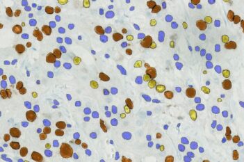 Nuclei DAB Intensity Quantification