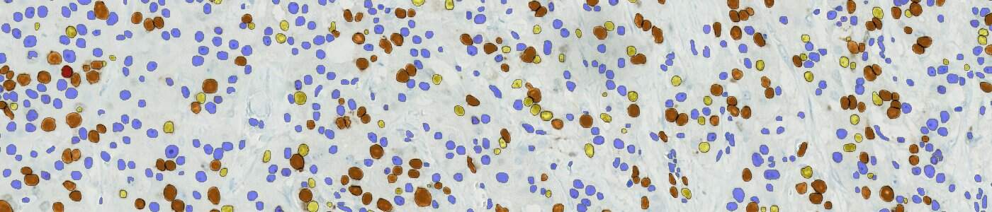 Nuclei DAB Intensity Quantification