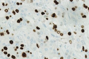 Nuclei DAB Intensity Quantification