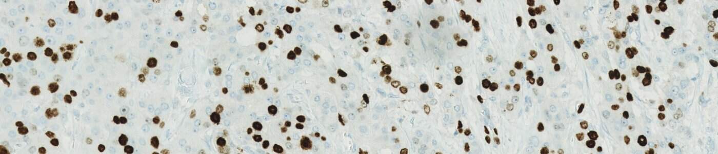 Nuclei DAB Intensity Quantification