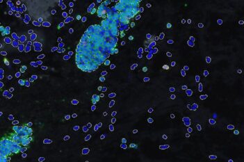 Cell Detection, AI (Fluorescence)