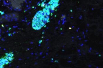 Cell Detection, AI (Fluorescence)