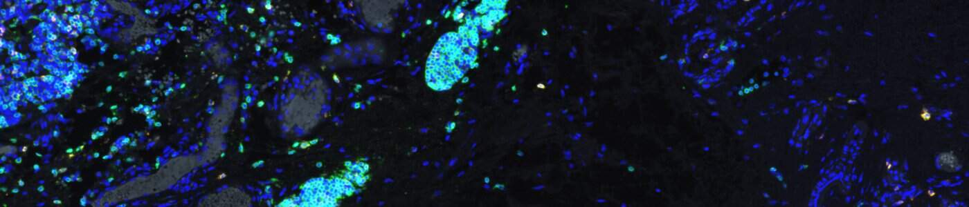 Cell Detection, AI (Fluorescence)