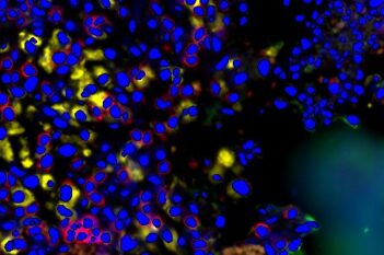 GeoMx® DSP Nuclei Detection