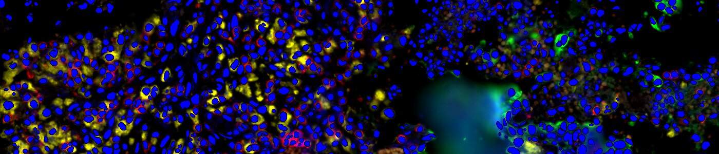 GeoMx® DSP Nuclei Detection