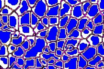 Cell Detection AI (IMC)