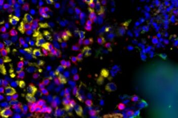 GeoMx® DSP Nuclei Detection
