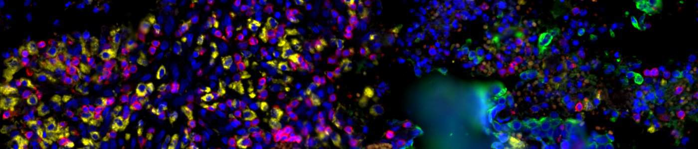 GeoMx® DSP Nuclei Detection