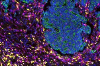 GeoMx® DSP Cell Detection