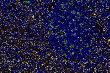 GeoMx® DSP Cell Detection