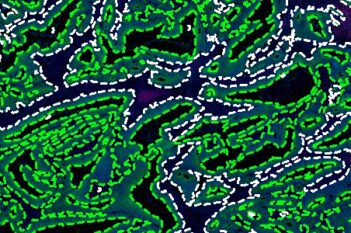 GeoMx® DSP panCK Detection