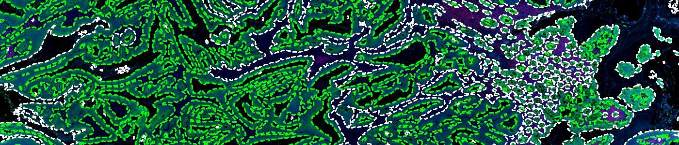 GeoMx® DSP panCK Detection