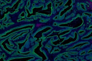 GeoMx® DSP panCK Detection