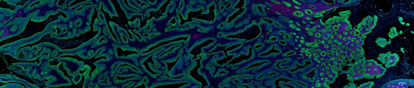 GeoMx® DSP panCK Detection