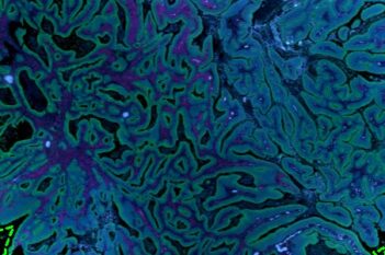 GeoMx® DSP Tissue Detection