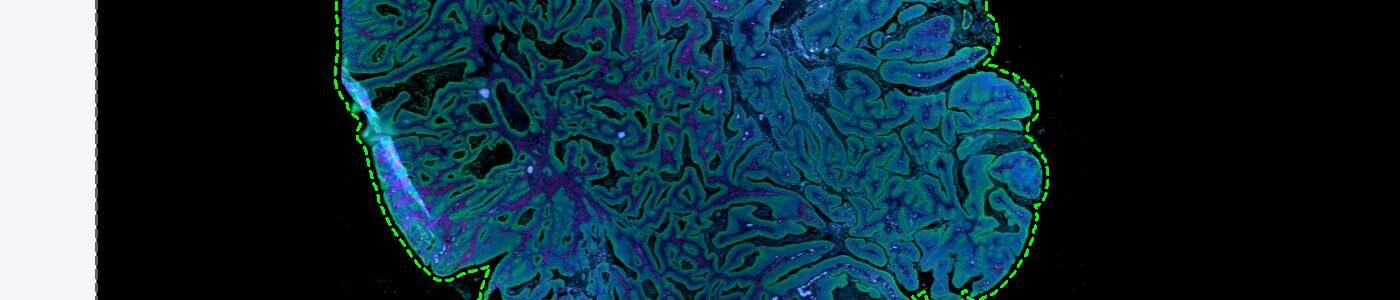 GeoMx® DSP Tissue Detection