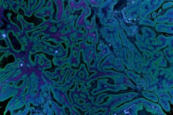 GeoMx® DSP Tissue Detection