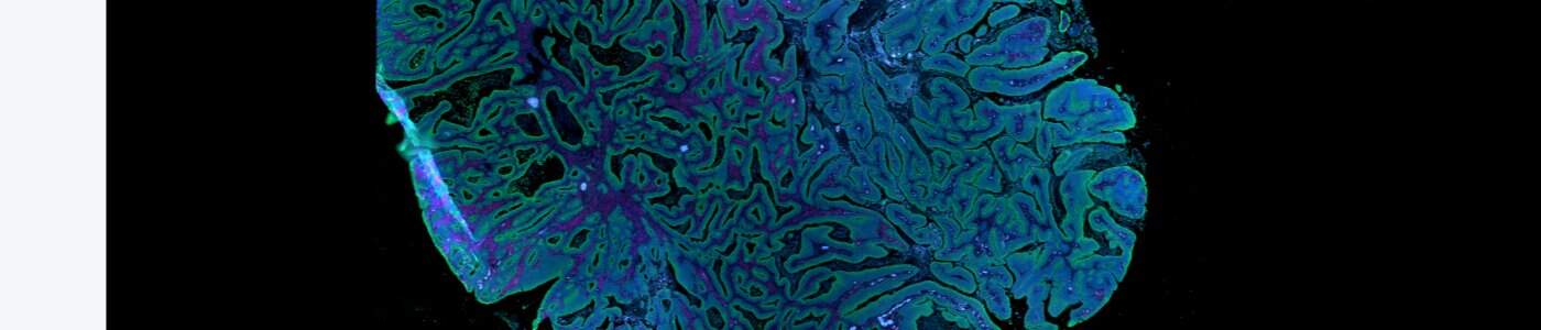 GeoMx® DSP Tissue Detection