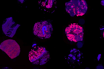 Tissue Detection, Fluorescence, 8bit
