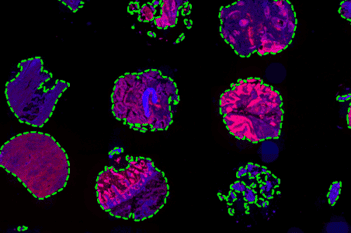 Tissue Detection, Fluorescence, 8bit