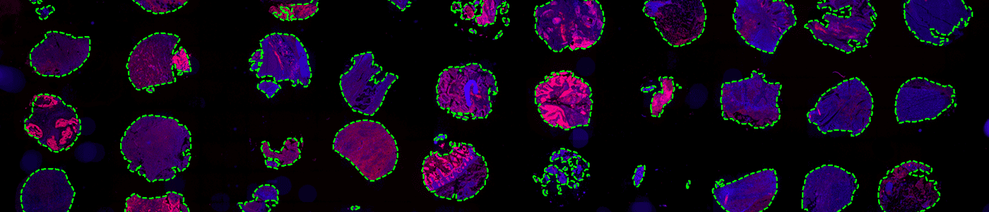 Tissue Detection, Fluorescence, 8bit