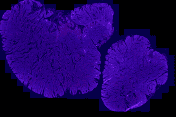 Tissue Detection, Fluorescence, 16bit