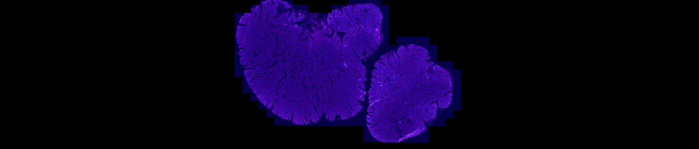 Tissue Detection, Fluorescence, 16bit
